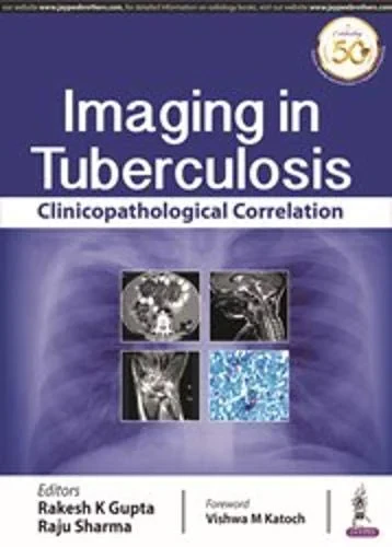 Coperta cărții "Imaging in Tuberculosis" de By Rakesh K Gupta, By Raju Sharma