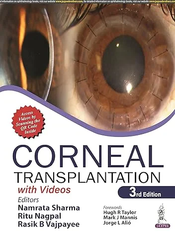  Corneal Transplantation