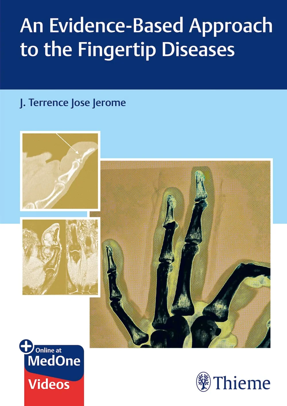 Coperta cărții "An Evidence-Based Approach to the Fingertip Diseases" de J Terrence Jerome