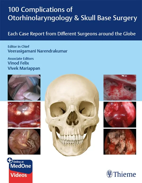 Coperta cărții "100 Complications of Otorhinolangyngology &amp; Skull Base Surgery" de Veerasigamani Narendrakumar, Vinod Felix, Vivek Mariappan