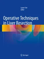 Coperta cărții "Operative Techniques in Liver Resection" de Lunan Yan