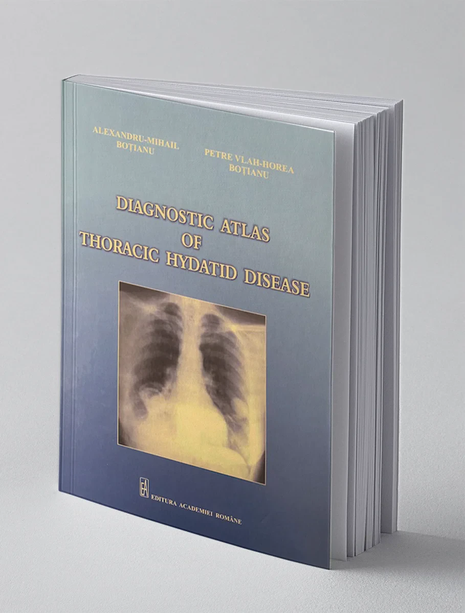 Coperta cărții "Diagnostic atlas of thoracic hydatid disease" de Alexandru Mihail Botianu, Petre Vlah Horea Botianu