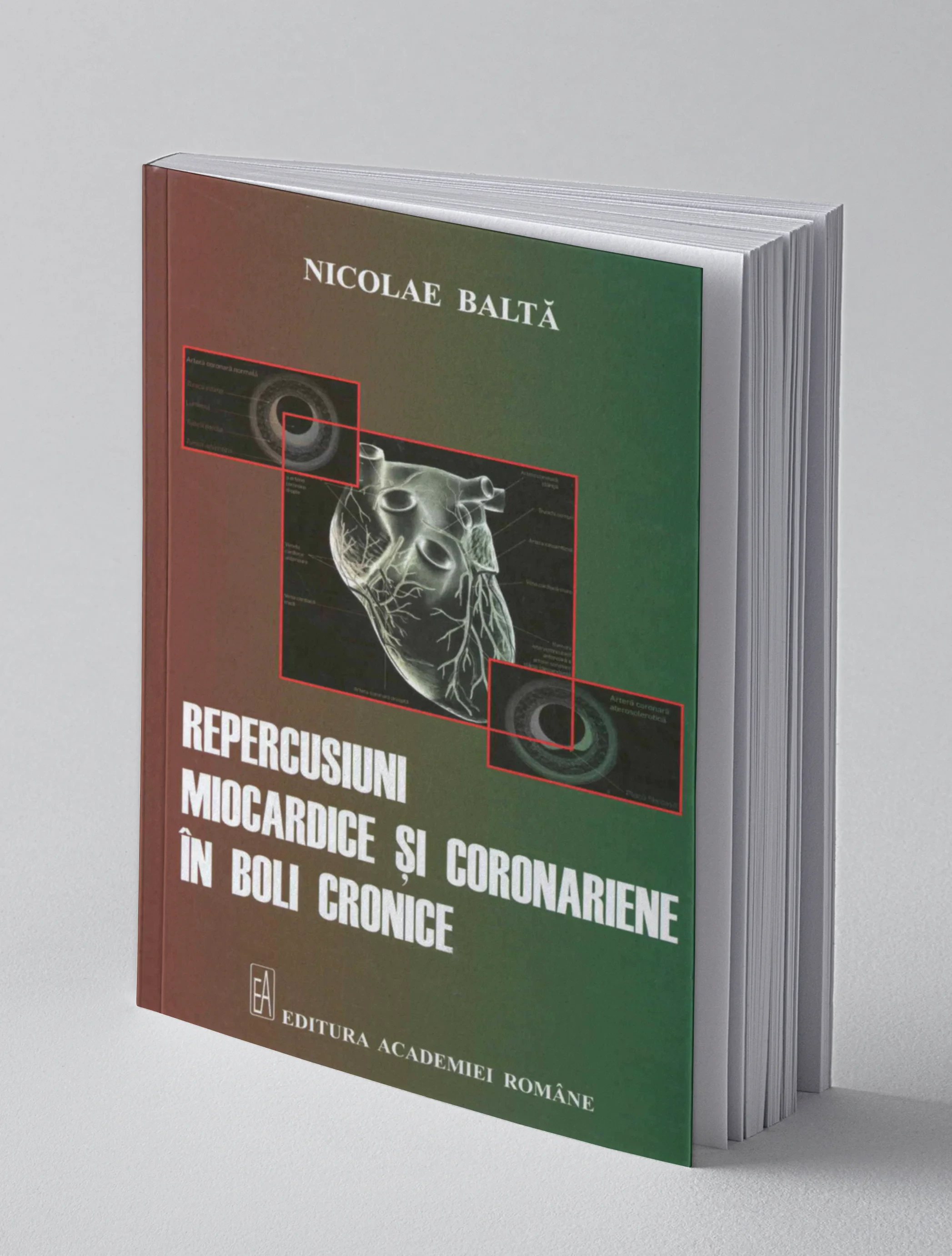 Coperta cărții "Repercusiuni miocardice si coronariene in boli cronice" de Nicolae Balta