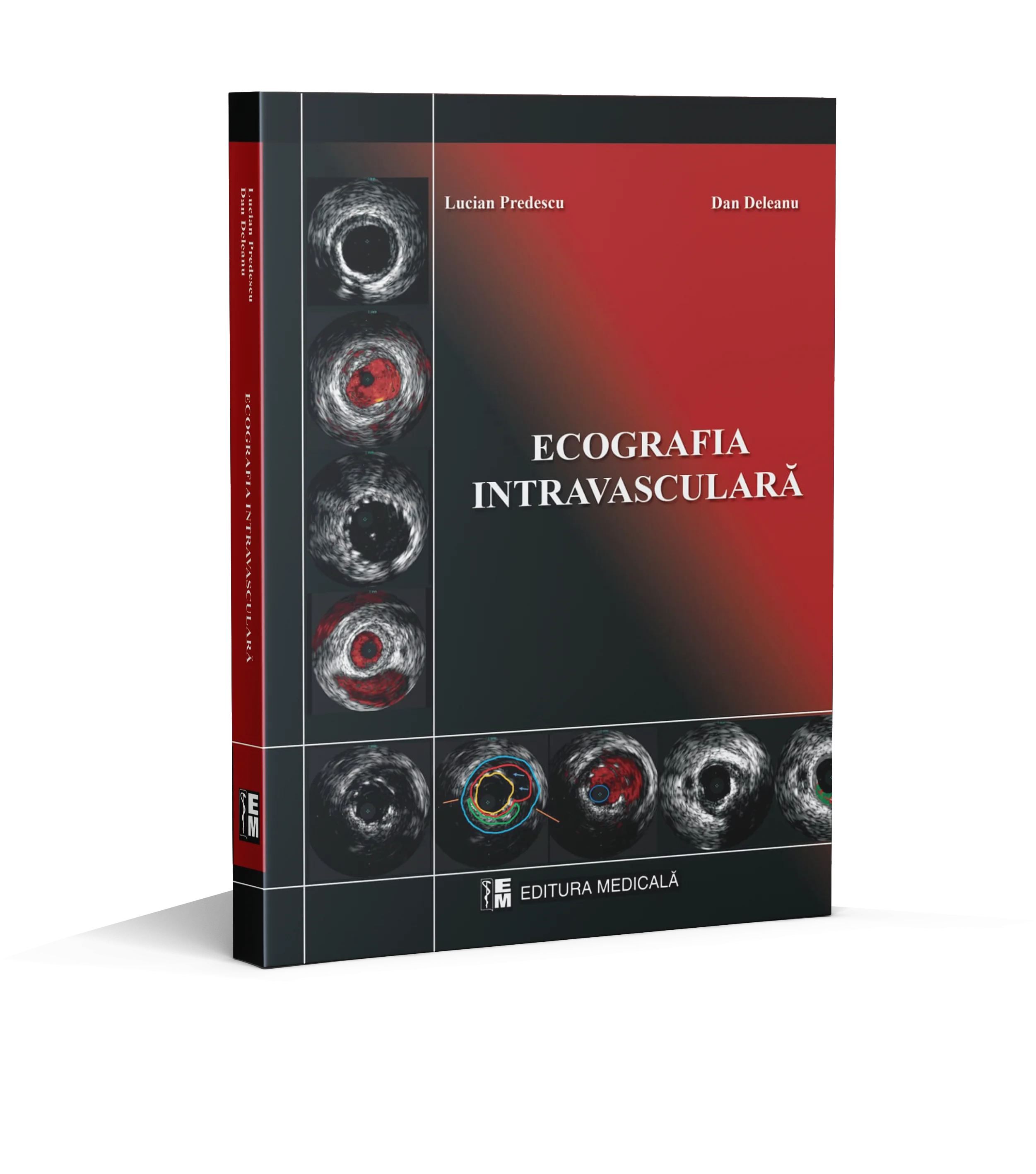 Coperta cărții "Ecografie intravasculara" de Dan Deleanu, Lucian Predescu