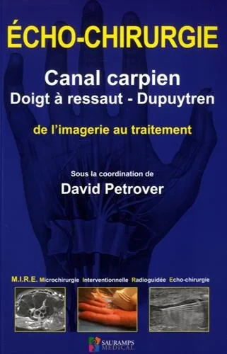 Coperta cărții "ECHO-CHIRURGIE - CANAL CARPIEN-DOIGT A RESSAUT-DUPUYTREN" de PETROVER DAVID