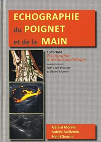 Coperta cărții "ECHOGRAPHIE DU POIGNET ET DE LA MAIN" de MORVAN GERARD