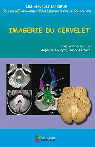 Coperta cărții "IMAGERIE DU CERVELET" de LOURYAN STEPHANE
