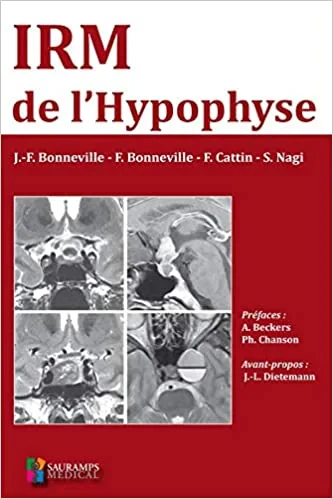 Coperta cărții "IRM DE L'HYPOPHYSE" de BONNEVILLE J-F