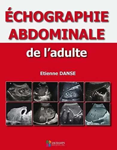 Coperta cărții "ECHOGRAPHIE ABDOMINALE DE L'ADULTE" de DANSE ETIENNE