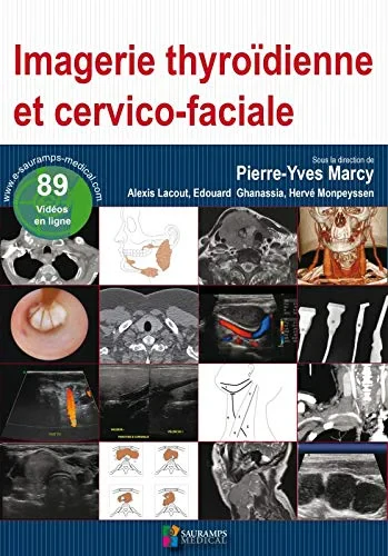 Coperta cărții "IMAGERIE THYROIDIENNE ET CERVICO-FACIALE" de MARCY P-Y