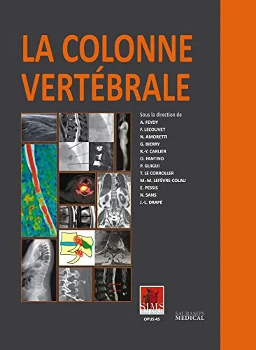 Coperta cărții "LA COLONNE VERTEBRALE" de FEYDY A.