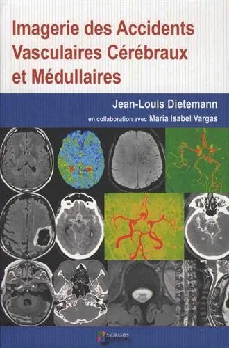 Coperta cărții "IMAGERIE DES ACCIDENTS VASCULAIRES CEREBRAUX ET MEDULLAIRES" de DIETEMANN JEAN-LOUIS