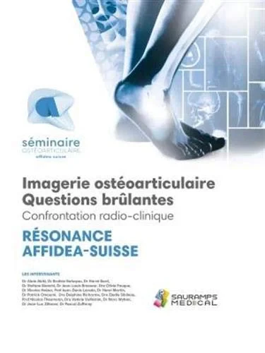 Coperta cărții "AFFIDEA IMAGERIE OSTEO-ARTICULAIRE QUESTIONS BRULANTES" de AKIKI ALAIN