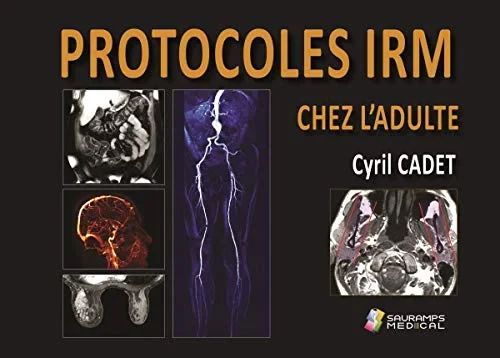 Coperta cărții "PROTOCOLES IRM CHEZ L'ADULTE" de CADET CYRIL