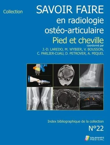 Coperta cărții "SAVOIR FAIRE EN RADIOLOGIE OSTEO-ARTICULAIRE N�22" de LAREDO J-D