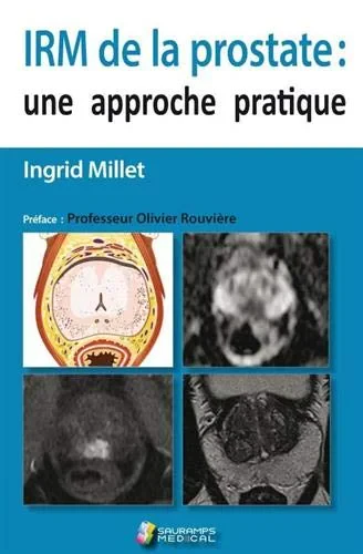 Coperta cărții "IRM DE LA PROSTATE" de MILLET INGRID