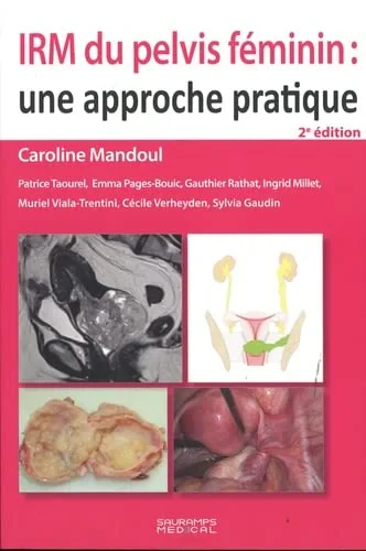 Coperta cărții "IRM DU PELVIS FEMININ : UNE APPROCHE PRATIQUE" de MANDOUL CAROLINE