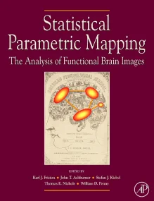 Statistical Parametric Mapping: The Analysis of Fu...