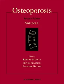 Osteoporosis, Two-Volume Set