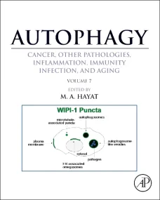 Autophagy: Cancer, Other Pathologies, Inflammation...
