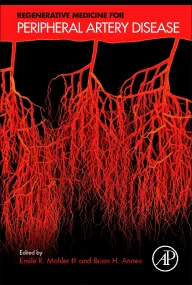 Regenerative Medicine for Peripheral Artery Diseas...