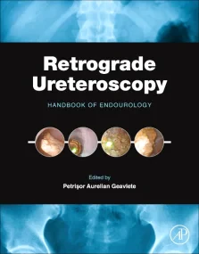 Retrograde Ureteroscopy: Handbook of Endourology