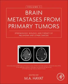 Brain Metastases from Primary Tumors, Volume 3