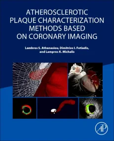 Atherosclerotic Plaque Characterization Methods Ba...