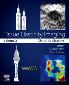 Tissue Elasticity Imaging