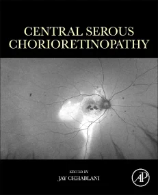 Central Serous Chorioretinopathy