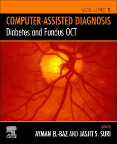 Diabetes and Fundus OCT