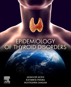 Epidemiology of Thyroid Disorders 
