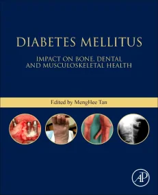 Diabetes Mellitus