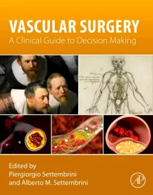 Vascular Surgery: A Clinical Guide to Decision-mak...