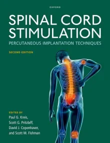 Spinal Cord Stimulation: Percutaneous Implantation...
