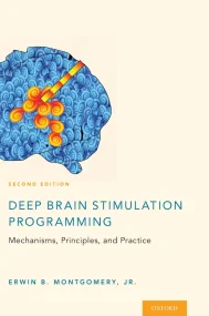 Deep Brain Stimulation Programming: Mechanisms, Pr...