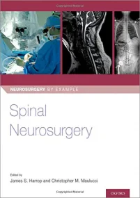 Spinal Neurosurgery
