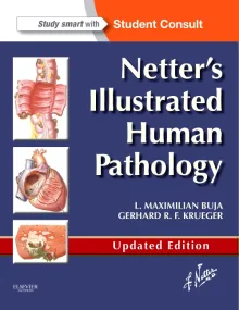 Netter's Illustrated Human Pathology Updated Editi...