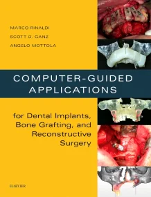 Computer-Guided Applications for Dental Implants, ...