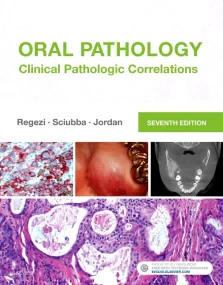 Oral Pathology: Clinical Pathologic Correlations, ...
