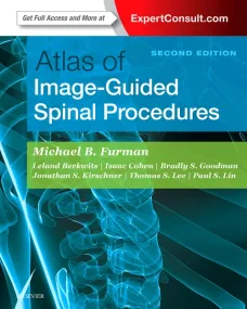 Atlas of Image-Guided Spinal Procedures, 2e