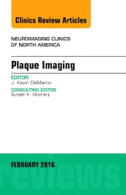 Plaque Imaging, An Issue of Neuroimaging Clinics o...