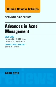 Advances in Acne Management, An Issue of Dermatolo...