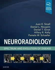 Neuroradiology: Spectrum and Evolution of Disease,...