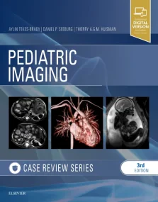 Pediatric Imaging: Case Review Series