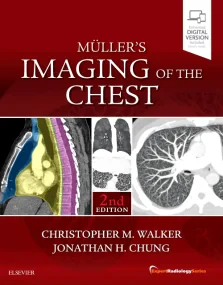 Muller's Imaging of the Chest: Expert Radiology Se...