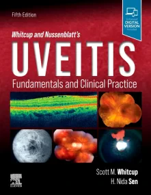 Whitcup and Nussenblatt’s Uveitis: Fundamentals an...