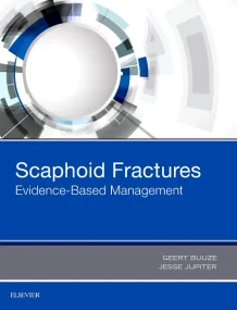 Scaphoid Fractures: Evidence-Based Management, 1e 