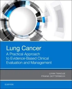 Lung Cancer: A Practical Approach to Evidence-Base...