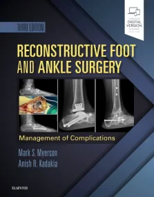 Reconstructive Foot and Ankle Surgery: Management ...